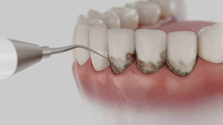 Reliable Wisdom Tooth Removal contractor in Benton County County, WA by Dentist Open Now